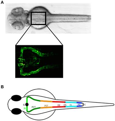 Zebrafish as a Model for Drug Screening in Genetic Kidney Diseases